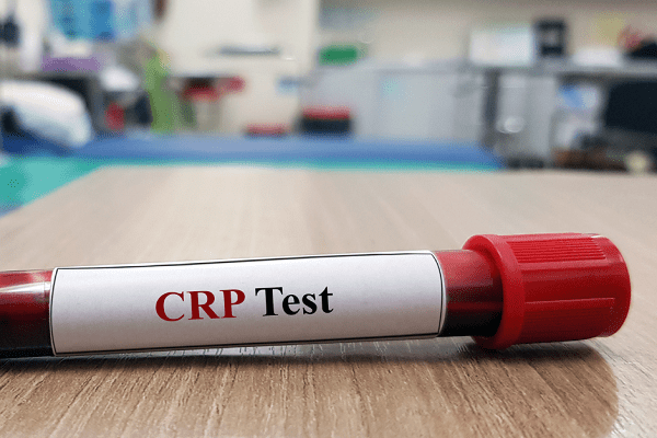 CRP Test